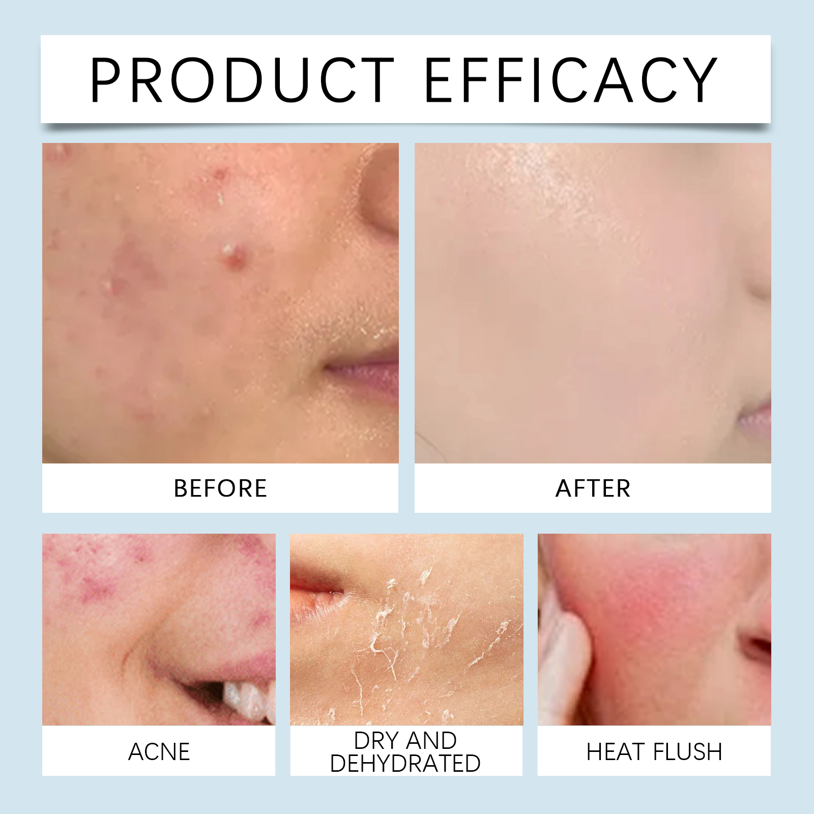 Hydrating roller Serum 0.25mm  - Luxury Skincare Collection recension och pris