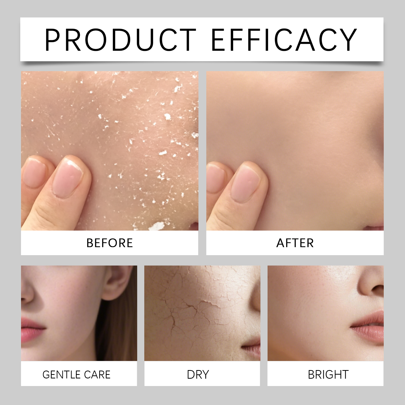 80ml Hydrating Mist for Anti D - High Luxury Skincare recension och pris